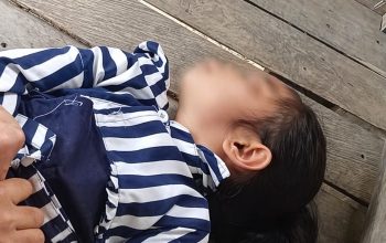 Derita Epilepsi, Seorang Anak (12) di Mambi Tak Pernah Berobat Lantaran Terkendala Ekonomi
