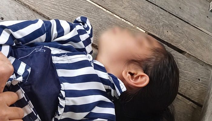 Derita Epilepsi, Seorang Anak (12) di Mambi Tak Pernah Berobat Lantaran Terkendala Ekonomi